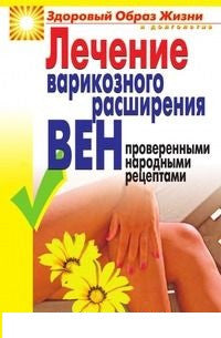 Лечение варикозного расширения вен проверенными народными рецептами